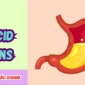 Acid Puns